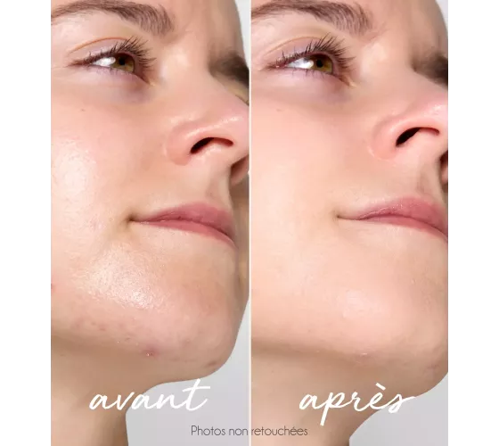 La Rosée Anti-imperfection tinted corrector...