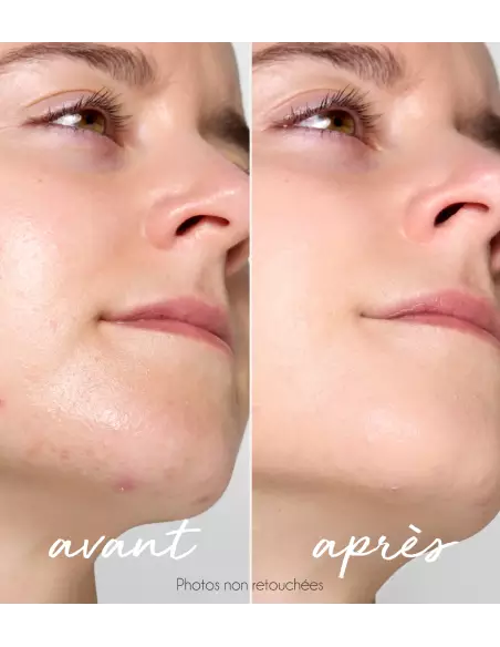 La Rosée Anti-imperfection tinted corrector stick 4.5G