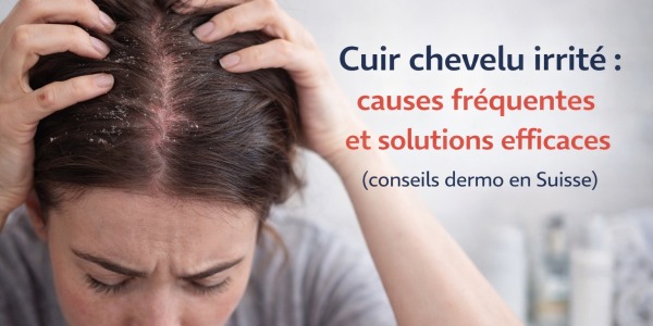 Cuir chevelu irrité : causes fréquentes et solutions efficace