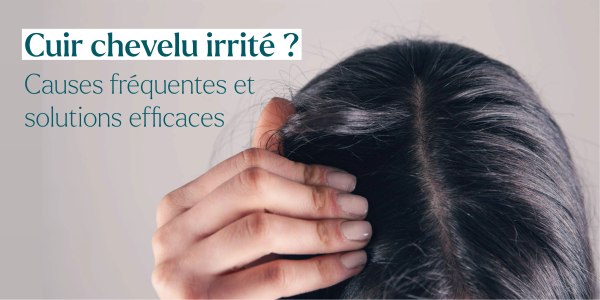 Cuir chevelu irrité : causes fréquentes et solutions efficace