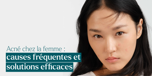Acné adulte femme : causes fréquentes et solutions efficaces (conseils dermo en Suisse)
