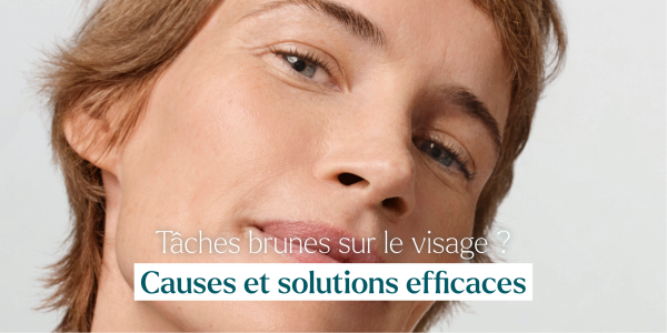 Taches brunes sur le visage : causes et solutions efficaces  pour le climat suisse